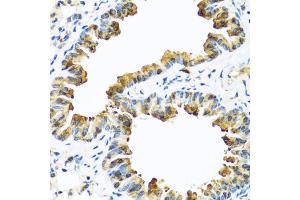Immunohistochemistry of paraffin-embedded mouse lung using SERPINA10 antibody (ABIN5974273) at dilution of 1/100 (40x lens).