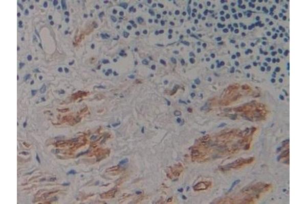 PRO-ANP antibody  (AA 25-123)
