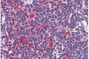 Human Thymus: Formalin-Fixed, Paraffin-Embedded (FFPE) (Caspase 7 antibody  (C-Term))