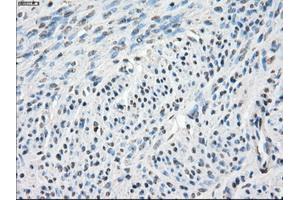 Immunohistochemical staining of paraffin-embedded endometrium tissue using anti-CA9mouse monoclonal antibody. (CA9 antibody)