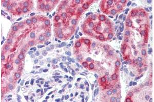 Mouse kidney: Formalin-Fixed, Paraffin-Embedded (FFPE) (IFIH1 antibody  (C-Term))
