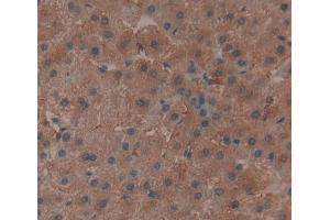 Immunohistochemistry (IHC) image for anti-TNF Receptor-Associated Protein 1 (TRAP1) (AA 60-704) antibody (ABIN5013673)