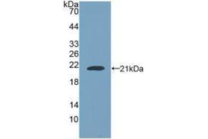 Western blot analysis of recombinant Human NUP210. (NUP210 antibody  (AA 1288-1449))