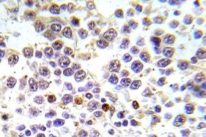 Immunohistochemistry (IHC) analyzes of p-Histone H3. (Histone H3.1 antibody  (pSer10))