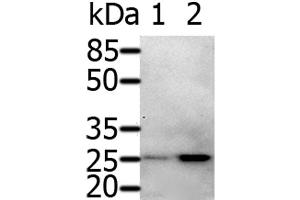 Western Blot analysis of 231 cell and Human fetal brain tissue using RAB5A Polyclonal Antibody at dilution of 1:600 (RAB5 antibody)