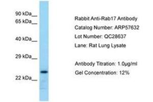 Image no. 1 for anti-RAB17, Member RAS Oncogene Family (RAB17) (AA 121-170) antibody (ABIN6749942) (RAB17 antibody  (AA 121-170))