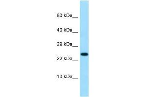 Western Blotting (WB) image for anti-Interleukin 19 (IL19) (C-Term) antibody (ABIN2789719) (IL-19 antibody  (C-Term))