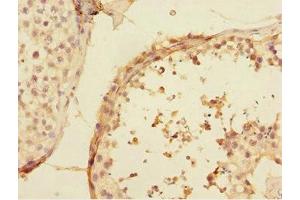 Immunohistochemistry of paraffin-embedded human testis tissue using ABIN7174506 at dilution of 1:100 (UBE2Z antibody  (AA 115-354))