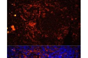 Immunofluorescence analysis of Rat spleen using CD11A Polyclonal Antibody at dilution of 1:100 (40x lens). (ITGAL antibody)