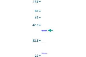 RBX1 Protein (AA 1-108) (GST tag)