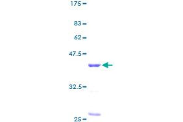 RBX1 Protein (AA 1-108) (GST tag)