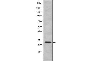 Western blot analysis SAP30 using 293 whole cell lysates