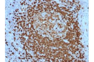 Formalin-fixed, paraffin-embedded human Lymph Node stained with TCL1 Mouse Monoclonal Antibody (TCL1/2079). (TCL1A antibody  (AA 2-109))