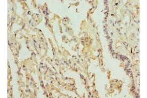 Immunohistochemistry of paraffin-embedded human lung tissue using ABIN7158277 at dilution of 1:100 (LILRB4 antibody  (AA 22-259))