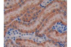 DAB staining on IHC-P; Samples: Mouse Kidney Tissue (JAK3 antibody  (AA 517-749))