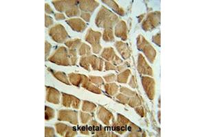 CAPN3 Antibody (C-term) IHC analysis in formalin fixed and paraffin embedded skeletal muscle followed by peroxidase conjugation of the secondary antibody and DAB staining. (Calpain 3 antibody  (C-Term))