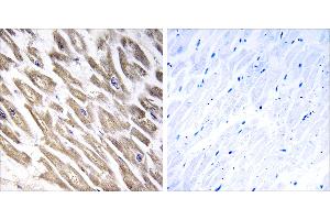 Peptide - + (F13B antibody)