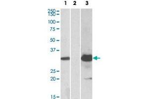 HEK293 lysate (10 ug protein in RIPA buffer) overexpressing human KCTD11 with DYKDDDDK tag probed with KCTD11 polyclonal antibody  (1. (KCTD11 antibody  (Internal Region))