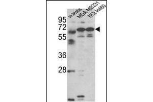 Western blot analysis of Fascin-3 Antibody (N-term) (ABIN390722 and ABIN2840998) in MDA-M, NCI- cell line and mouse testis tissue lysates (35 μg/lane). (Fascin 3 antibody  (N-Term))