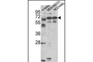 Western blot analysis of Fascin-3 Antibody (N-term) (ABIN390722 and ABIN2840998) in MDA-M, NCI- cell line and mouse testis tissue lysates (35 μg/lane).