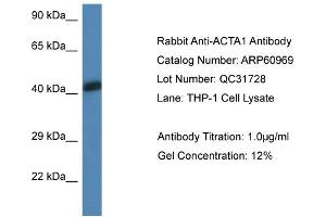 Western Blotting (WB) image for anti-Actin, alpha 1, Skeletal Muscle (ACTA1) (N-Term) antibody (ABIN2788636) (Actin antibody  (N-Term))