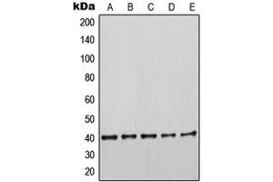 Western blot analysis of Cytokeratin 19 expression in HeLa (A), MCF7 (B), SKBR3 (C), MDAMB435 (D), HEK293T (E) whole cell lysates. (Cytokeratin 19 antibody  (Center))