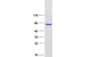 Validation with Western Blot
