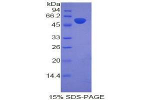 SDS-PAGE analysis of Rat Adrenocorticotropic Hormone Protein. (POMC Protein)