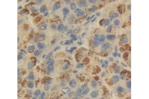 Figure. (LSS antibody  (AA 388-549))