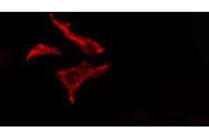 ABIN6278571 staining  HT29 cells by IF/ICC. (FZD7 antibody  (C-Term))