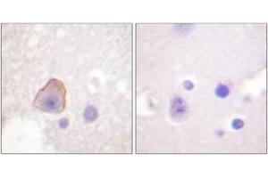 Immunohistochemistry analysis of paraffin-embedded human brain tissue, using ADD1 (Ab-726) Antibody. (alpha Adducin antibody  (AA 688-737))