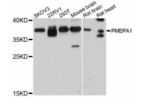 Western blot analysis of extracts of various cell lines, using PMEPA1 antibody (ABIN5998544) at 1:3000 dilution. (PMEPA1 antibody)