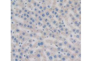 Figure. (Transferrin antibody  (AA 380-565))