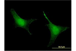 Immunofluorescence of monoclonal antibody to PREP on HeLa cell. (PREP antibody  (AA 611-710))
