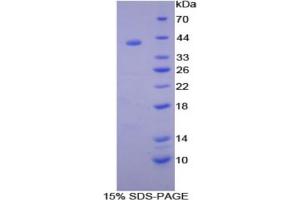 SDS-PAGE analysis of Rat Syndecan 1 Protein.