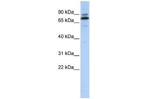 C14ORF21 antibody used at 1 ug/ml to detect target protein. (C14orf21 antibody  (Middle Region))