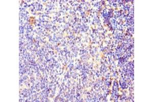 Immunohistochemistry of paraffin-embedded human lymphoid tissue using ABIN7170927 at dilution of 1:100 (OXCT1 antibody  (AA 40-520))