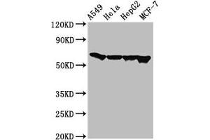 Western Blot Positive WB detected in: A549 whole cell lysate, Hela whole cell lysate, HepG2 whole cell lysate, MCF-7 whole cell lysate All lanes: FZD10 antibody at 3 μg/mL Secondary Goat polyclonal to rabbit IgG at 1/50000 dilution Predicted band size: 66 kDa Observed band size: 66 kDa (FZD1 antibody  (AA 125-225))