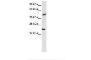 Image no. 1 for anti-IKAROS Family Zinc Finger 5 (Pegasus) (IKZF5) (N-Term) antibody (ABIN6735950) (IKZF5 antibody  (N-Term))