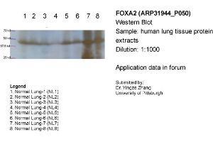 Sample Type: Human lung tissue protein extractsPrimary Dilution: 1:1000Secondary (Anti-Rabbit HRP sc-2004) Dilution: 1:1000 (FOXA2 antibody  (Middle Region))