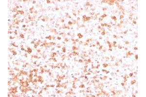 Formalin-fixed, paraffin-embedded human Tonsil stained with Lambda Light Chain Recombinant Mouse Monoclonal Antibody (rLLC/3777). (Recombinant IgL antibody)
