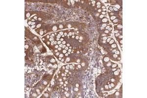 Immunohistochemical staining of human small intestine with FCHO2 polyclonal antibody  shows moderate cytoplasmic positivity in glandular cells. (FCHO2 antibody)