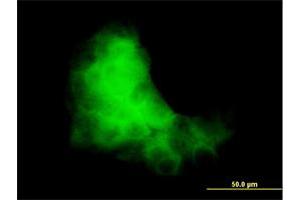 Immunofluorescence (IF) image for anti-S100 Calcium Binding Protein A7 (S100A7) (AA 1-101) antibody (ABIN562776)