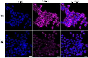 anti-Eukaryotic Translation Initiation Factor 4A1 (EIF4A1) antibody