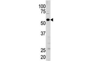 Western Blotting (WB) image for anti-Guanylate Cyclase 1 Soluble Subunit Alpha (GUCY1A1) antibody (ABIN3003008)