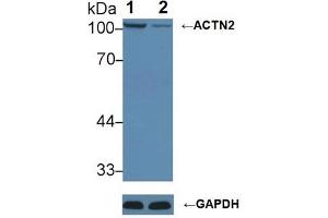 Western blot analysis of (1) Wild-type HeLa cell lysate, and (2) ACTN2 knockout HeLa cell lysate, using Rabbit Anti-Mouse ACTN2 Antibody (1 µg/ml) and HRP-conjugated Goat Anti-Mouse antibody ( (ACTN2 antibody  (AA 1-254))