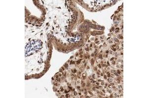 Immunohistochemical staining of human placenta with RPL12 polyclonal antibody  shows strong cytoplasmic positivity in trophoblastic cells and decidual cells at 1:20-1:50 dilution.