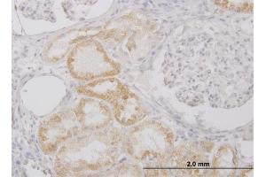 Immunoperoxidase of monoclonal antibody to PI15 on formalin-fixed paraffin-embedded human kidney. (PI15 antibody  (AA 18-117))