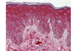 Immunohistochemistry (IHC) image for anti-Decorin (DCN) (N-Term) antibody (ABIN2783275) (Decorin antibody  (N-Term))