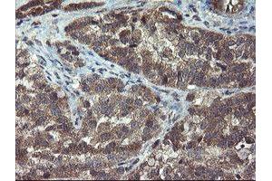 Image no. 3 for anti-Crystallin, Zeta, Homolog antibody (ABIN1497658) (CRYZL1 antibody)